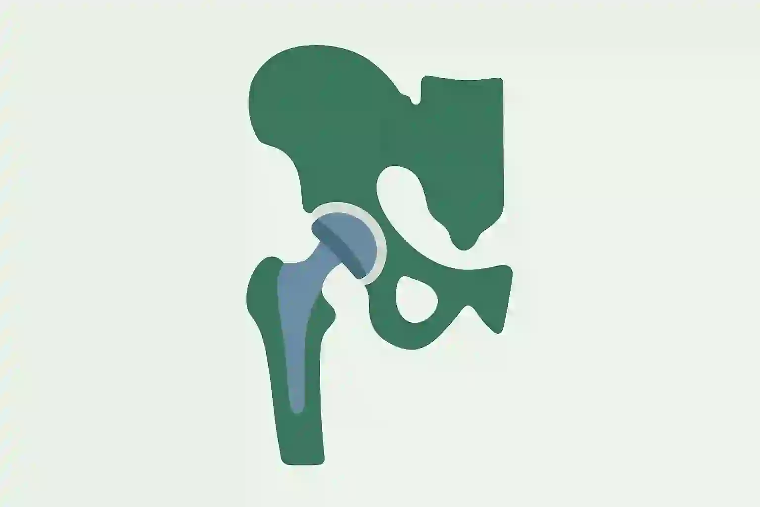 Hip Replacement - Orthopedics