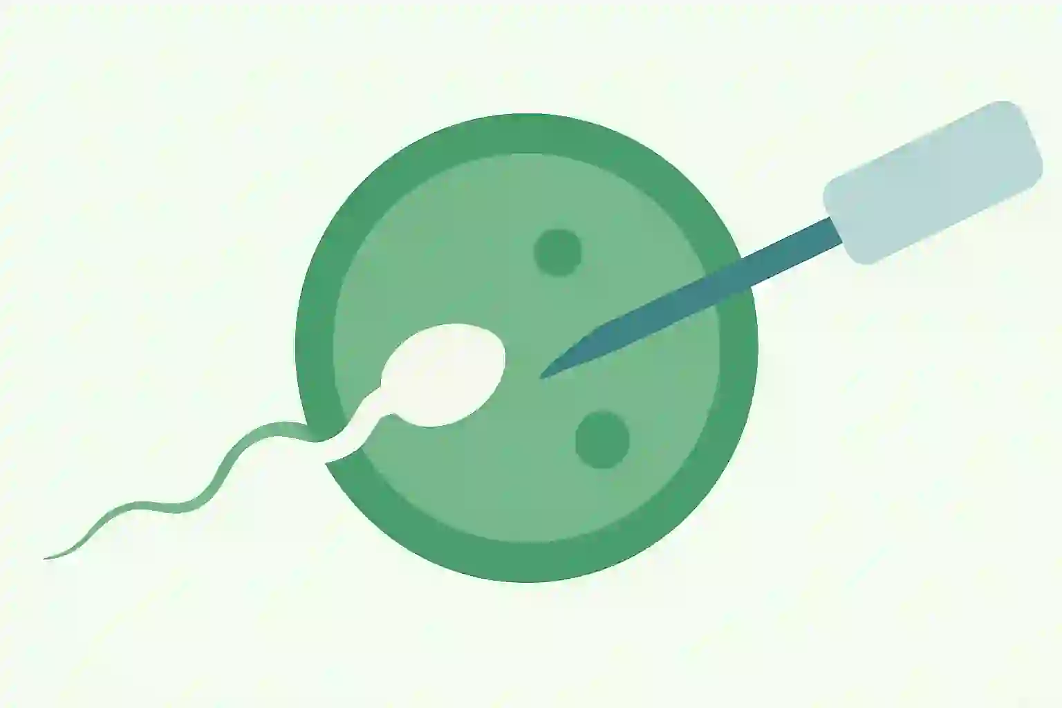 In-Vitro Fertilization (IVF) - Infertility