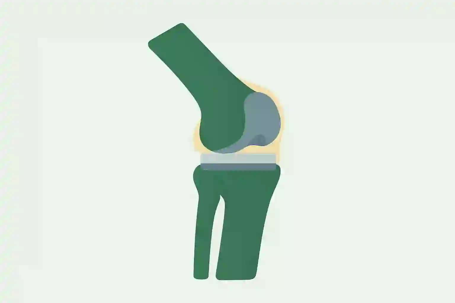 Total Knee Replacement(Single) - Orthopedics